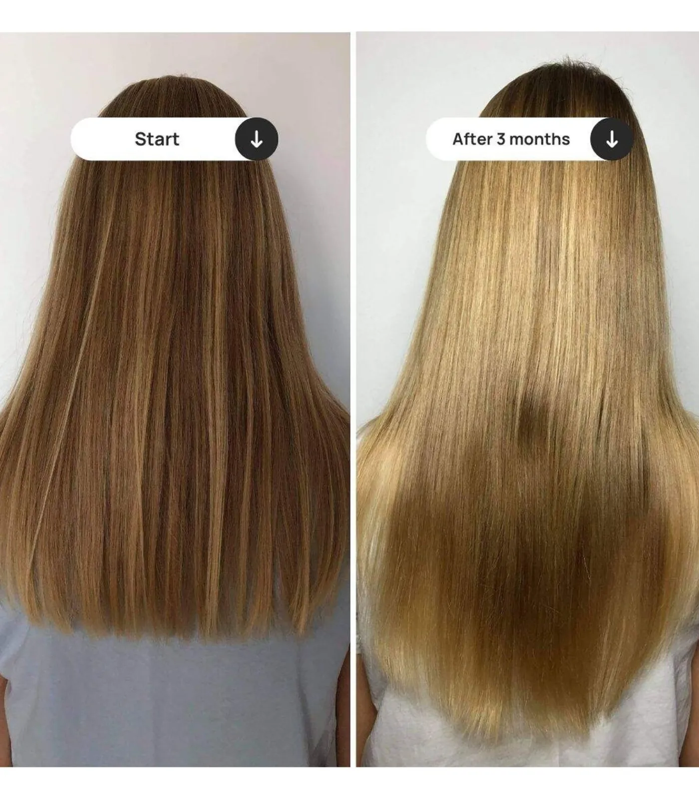 Sale Hair Ggrowth kit Shampoo