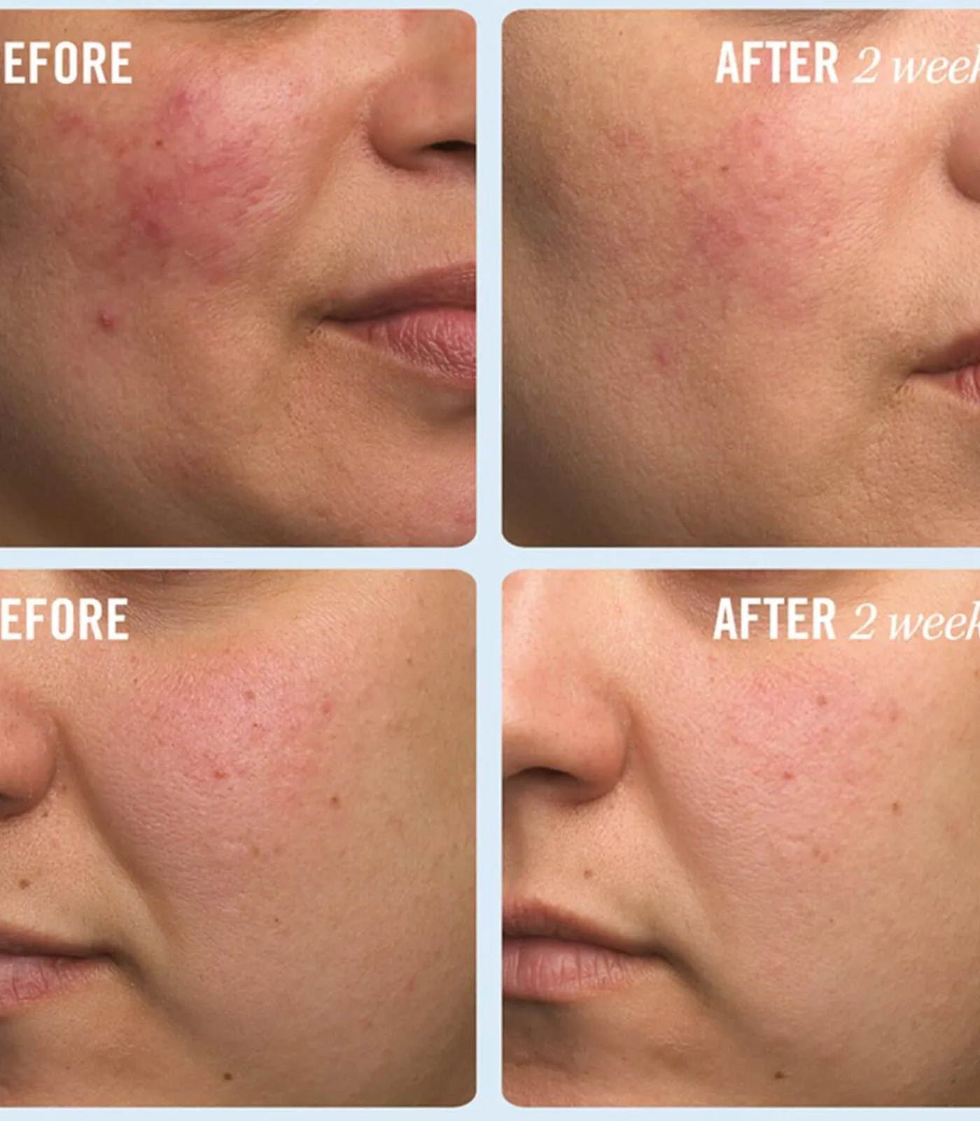 New Ultra Repair Cream Intense Repair - 170 ml Bodylotions & Bodymilks